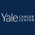 yale cancer center